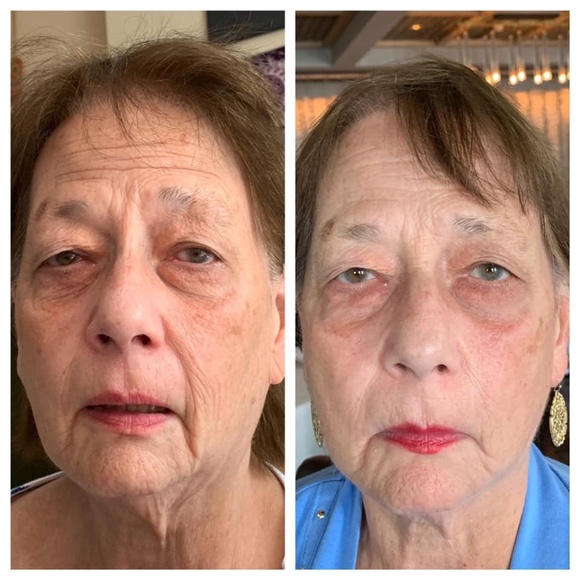 Pure Nerium Anti-Aging Age Defying Night Cream 1oz - Picture 7 of 11